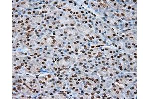 Immunohistochemical staining of paraffin-embedded lung tissue using anti-DAPK2 mouse monoclonal antibody. (DAPK2 Antikörper)