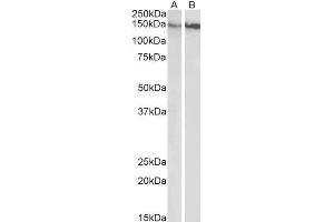 ABIN5539624 (0. (ITGB1 Antikörper  (Internal Region))