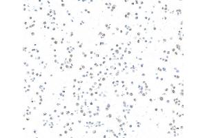 Immunocytochemistry (ICC) image for anti-AT Rich Interactive Domain 1A (SWI-Like) (ARID1A) (AA 750-800) antibody (ABIN7795677) (Rekombinanter ARID1A Antikörper  (AA 750-800))