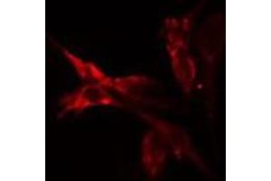 ABIN6275501 staining HeLa cells by IF/ICC.
