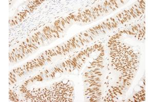 Immunohistochemistry (IHC) image for anti-KH-Type Splicing Regulatory Protein (KHSRP) (AA 100-150) antibody (ABIN7448625)