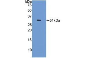Western blot analysis of recombinant Human CENPI. (CENPI Antikörper  (AA 292-528))