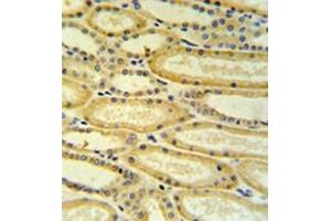 Immunohistochemistry analysis in formalin fixed and paraffin embedded lung tissue reacted with 17-beta-HSD11 / HSD17B11 Antibody (N-term) followed which was peroxidase conjugated to the secondary antibody and followed by DAB staining. (HSD17B11 Antikörper  (N-Term))