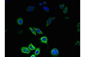 Immunofluorescent analysis of PC-3 cells using ABIN7163210 at dilution of 1:100 and Alexa Fluor 488-congugated AffiniPure Goat Anti-Rabbit IgG(H+L) (PIGC Antikörper  (AA 1-50))