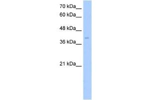 ZDHHC17 antibody used at 5 ug/ml to detect target protein. (ZDHHC17 Antikörper  (Middle Region))
