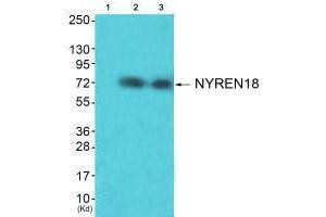 Western blot analysis of extracts from HuvEc cells (Lane 2) and JK cells (Lane 3), using NYREN18 antiobdy. (NUB1 Antikörper  (C-Term))