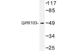 Image no. 1 for anti-Pyroglutamylated RFamide Peptide Receptor (QRFPR) antibody (ABIN317864) (QRFPR Antikörper)