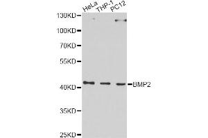 Western blot analysis of extracts of various cell lines, using BMP2 Antibody. (BMP2 Antikörper)