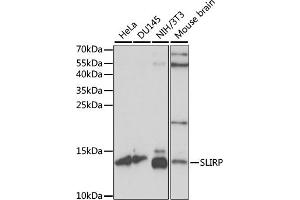 Western blot analysis of extracts of various cell lines, using SLIRP antibody (ABIN7270560) at 1:1000 dilution. (SLIRP Antikörper  (AA 1-100))