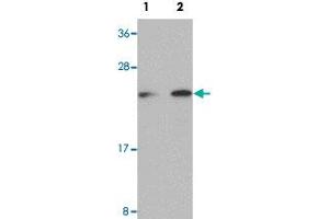 Western blot analysis of Raji cells with LIN28 polyclonal antibody  at (Lane 1) 1 and (Lane 2) 2 ug/mL dilution.