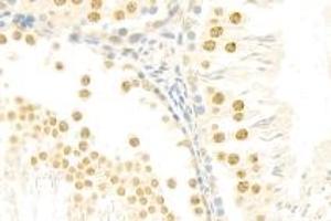 Immunohistochemistry analysis of paraffin-embedded rat testis using mSin3A (ABIN7075609) at dilution of 1: 100 (SIN3A Antikörper)