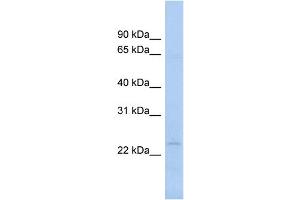 WB Suggested Anti-NAT9 Antibody Titration:  0. (NAT9 Antikörper  (N-Term))