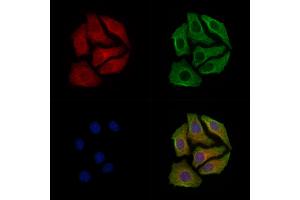 Phospho-GAP43 (Ser41) Antibody staining Hela cells(heat shock treatment) by IF/ICC.