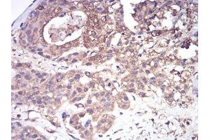 Immunohistochemistry (IHC) image for anti-Complement Factor H-Related 5 (CFHR5) (AA 344-569) antibody (ABIN5542640)