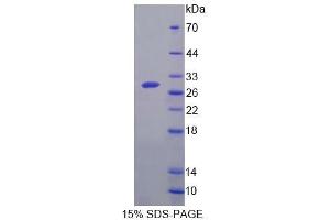 SDS-PAGE analysis of Mouse GCPII Protein. (PSMA Protein)
