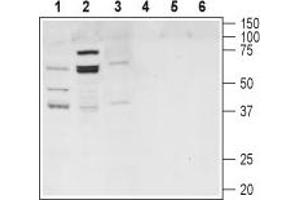 Western blot analysis of rat brain (lanes 1 and 4), mouse liver (lanes 2 and 5) and rat spleen (lanes 3 and 6) lysates: - 1-3.