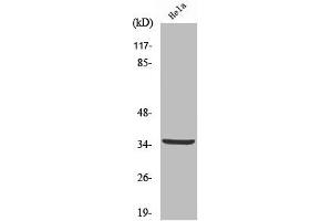 Western Blot analysis of HeLa cells using Cleaved-Cathepsin L2 (L114) Polyclonal Antibody (Cathepsin L2 Antikörper  (Cleaved-Leu114))