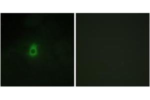Immunofluorescence analysis of HepG2 cells, using Cytochrome P450 2E1 Antibody.