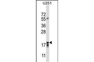 Western blot analysis in U251 cell line lysates (35ug/lane). (CTAG2 Antikörper  (AA 122-149))