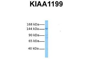 Host:  Rabbit  Target Name:  KIAA1199  Sample Tissue:  Human OVCAR-3  Antibody Dilution:  1.