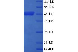 SDS-PAGE (SDS) image for Citrate Synthase (CS) (AA 28-464), (partial) protein (His tag) (ABIN5709331)
