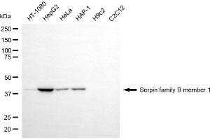Western blotting analysis using serpin family B member 1 antibody (ABIN7800319).