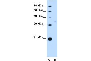 WB Suggested Anti-RFC3 Antibody Titration:  0. (RFC3 Antikörper  (N-Term))