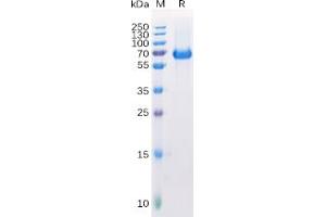 Human EPHA2 Protein, His Tag on SDS-PAGE under reducing condition.