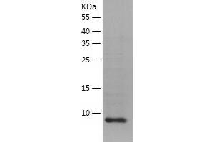 Western Blotting (WB) image for Vesicle-Associated Membrane Protein 2 (Synaptobrevin 2) (VAMP2) (AA 1-94) protein (His tag) (ABIN7125711) (VAMP2 Protein (AA 1-94) (His tag))
