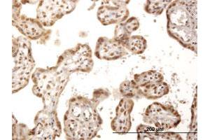 Immunohistochemistry (Formalin-fixed Paraffin-embedded Sections) (IHC (fp)) image for anti-Inositol-Tetrakisphosphate 1-Kinase (ITPK1) (AA 1-314) antibody (ABIN517270)