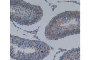 Used in DAB staining on fromalin fixed paraffin- embedded Kidney tissue (SPA17 Antikörper  (AA 1-140))