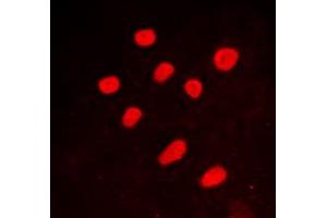 Immunofluorescent analysis of CTBP2 staining in A549 cells. (CTBP2 Antikörper  (C-Term))