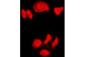 Immunofluorescent analysis of Nucleophosmin (pT199) staining in HeLa cells. (NPM1 Antikörper  (pSer199))