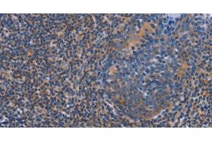 Immunohistochemistry of paraffin-embedded Human tonsil using AGFG1 Polyclonal Antibody at dilution of 1:60 (AGFG1 Antikörper)