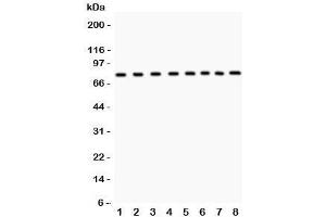 Western blot testing of MCM7 antibody and Lane 1:  rat brain;  2: human placenta;  3: mouse NIH3T3;  4: (h) HeLa;  5: (h) Jurkat;  6: (h) 22RV1;  7: (h) COLO320;  8: (r) PC12 lysate. (MCM7 Antikörper  (AA 526-719))