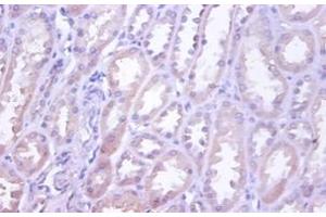 Immunohistochemistry (IHC) image for anti-Tumor Necrosis Factor Receptor Superfamily, Member 10d, Decoy with Truncated Death Domain (TNFRSF10D) antibody (FITC) (ABIN2575625)