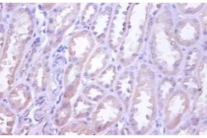 Immunohistochemistry of paraffin-embedded human kidney using TNFRSF10D / TRAIL-R4 / DCR2 antibody at dilution of 1:100. (DcR2 Antikörper  (FITC))