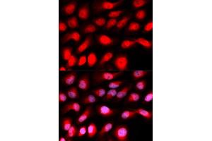 Immunofluorescence analysis of U20S cell using ZEB1 antibody. (ZEB1 Antikörper)
