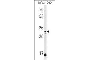 Western blot analysis of DDO Antibody (Center) (ABIN650991 and ABIN2840026) in NCI- cell line lysates (35 μg/lane). (DDO Antikörper  (AA 102-130))