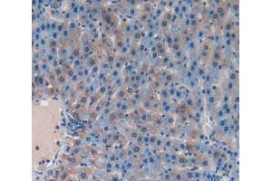Used in DAB staining on fromalin fixed paraffin- embedded liver tissue (RANKL Antikörper  (AA 106-240))