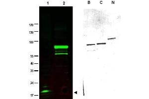 Image no. 1 for anti-SPANX Family, Member C (SPANXC) antibody (ABIN401033) (SPANXC Antikörper)
