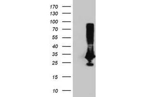Image no. 2 for anti-Phenylethanolamine N-Methyltransferase (PNMT) antibody (ABIN1500313) (PNMT Antikörper)