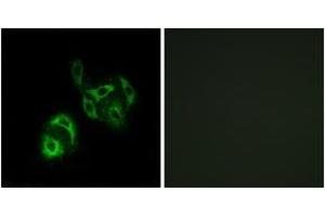 Immunofluorescence analysis of A549 cells, using SLC27A4 Antibody. (SLC27A4 Antikörper  (AA 61-110))