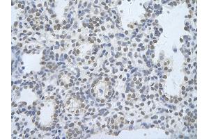 Immunohistochemistry (IHC) image for anti-CUGBP, Elav-Like Family Member 2 (CELF2) (N-Term) antibody (ABIN2778745)
