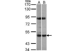 WB Image Sample(30 μg of whole cell lysate) A:293T B:H1299 7. (MAPKAP Kinase 5 Antikörper)