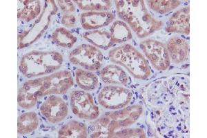 Immunohistochemical analysis of paraffin-embedded human kidney, using Caspase-3 p12 Antibody. (Rekombinanter Caspase 3 p12 Antikörper)