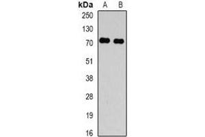 Western blot analysis of TBRG4 expression in Hela (A), HepG2 (B) whole cell lysates. (TBRG4 Antikörper)