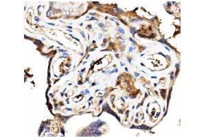 IHC analysis of Stathmin 1 using anti-Stathmin 1 antibody (ABIN3043301).