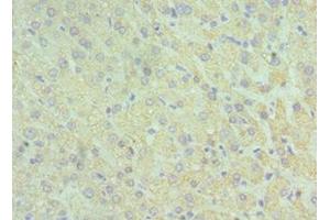 Immunohistochemistry of paraffin-embedded human liver tissue using ABIN7153959 at dilution of 1:100 (GLUD2 Antikörper  (AA 319-558))