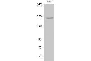 Western Blotting (WB) image for anti-Myomesin 2 (MYOM2) (Internal Region) antibody (ABIN3176183) (MYOM2 Antikörper  (Internal Region))